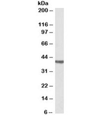 CTnT Antibody