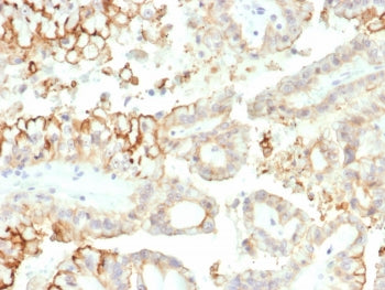 B7-H3 Antibody / CD276