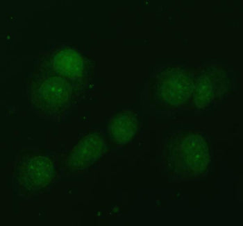 Immunofluorescent staining of FFPE human T-47D cells with NDRG2 antibody (green). HIER: steam sectio