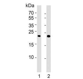 Western blot testing of human 1) brain and 2) kidney tissue lysate with FGF9 antibody. Predicted mol