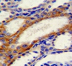 STIM1 antibody immunohistochemistry analysis in formalin fixed and paraffin embedded human kidney ti