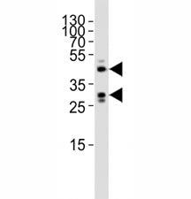 Western blot analysis of lysate from mouse heart tissue lysate using SIRT3 antibody diluted at 1:100