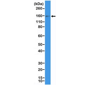 Western blot testing of human placental tissue with recombinant CD117 antibody at 1:200 dilution. Ob