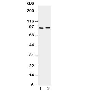 Western blot testing of ADAMTS4 antibody and Lane 1: rat brain; 2: mouse brain tissue lysate