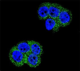Confocal immunofluorescent analysis of PDGFRB antibody with WiDr cells followed by Alexa Fluor 488-c
