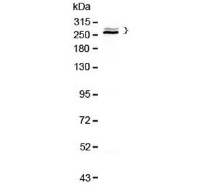 Desmoplakin Antibody
