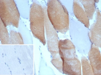 MYH7 Antibody / Myosin 7