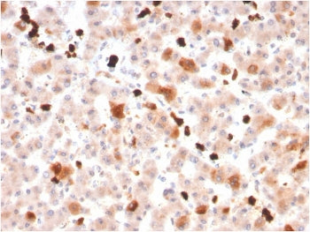 IHC staining of FFPE human liver with APOA1 antibody. HIER: boil tissue sections in pH 9 10mM Tris w