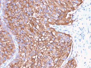 IHC staining of FFPE human urinary bladder with UPK1A antibody (clone UPK1A/2922). HIER: boil tissue