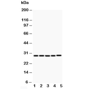 Western blot testing of CD40L antibody and Lane 1: MCF-7; 2: HeLa; 3: Jurkat; 4: HMY2; 5: COLO320; E