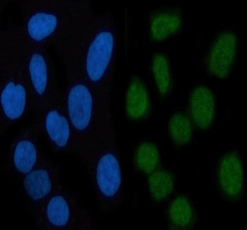 Immunofluorescent staining of FFPE human HeLa cells with Phospho-STAT3 antibody (green) and DAPI nuc