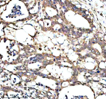 Immunohistochemical staining of PAN3 using anti-PAN3 antibody. PAN3 was detected in a paraffin-embed