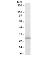 Western blot testing of human lung lysate with GSTM1 antibody at 0.3ug/ml. Predicted molecular weigh