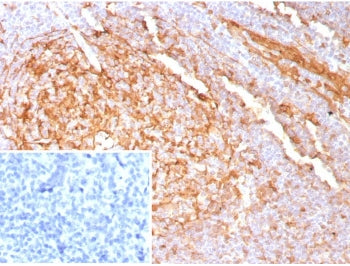 IHC staining of FFPE human tonsil tissue with recombinant Cystatin A antibody (clone CSTA/9087R). In