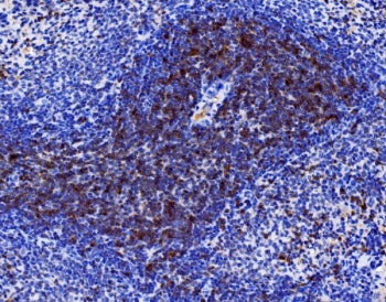 IHC staining of FFPE rat spleen tissue with Cd27 antibody. HIER: boil tissue sections in pH8 EDTA fo