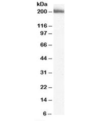 Western blot testing of human liver lysate with MYO9B antibody at 2ug/ml. Predicted molecular weight
