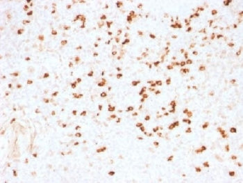 Lambda Light Chain Antibody / Lambda Antibody