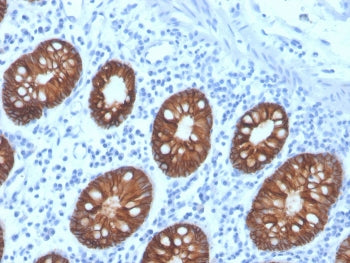 EpCAM Antibody