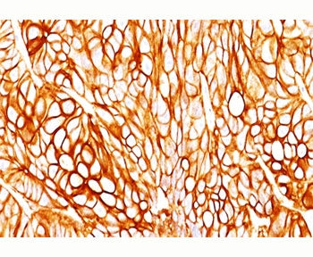 Cytokeratin 18 Antibody