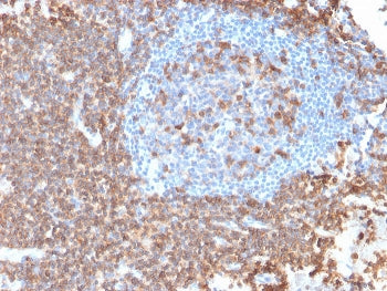 IHC testing of FFPE human lymph node with recombinant CD43 antibody (clone rSPN/839). Required HIER: