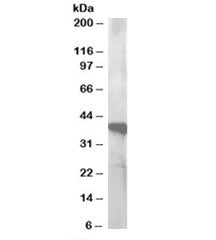 GIPC3 Antibody