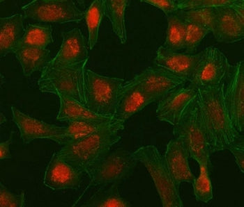 Immunofluorescent staining of FFPE human A549 cells with Interferon regulatory factor 5 antibody (re