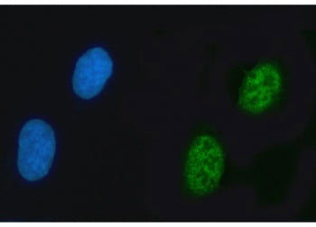 Immunofluorescent staining of FFPE human U-2 OS cells with KIAA0295 antibody (green) and DAPI nuclea