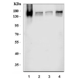 Western blot testing of 1) human A431, 2) human A549, 3) U-87 MG and 4) mouse liver tissue lysate wi