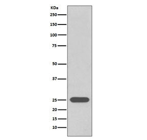 Western blot testing of human 293T cell lysate with UchL1 antibody. Predicted molecular weight ~25 k