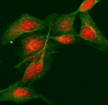 Immunofluorescent staining of FFPE human HeLa cells with LDOC1 antibody (red) and Beta Tubulin mAb (