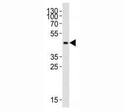 CCR2 Antibody