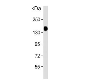 Western blot testing of human skeletal muscle tissue lysate with Glycogen debranching enzyme antibod