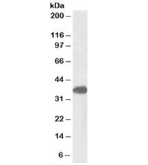 Western blot testing of mouse lung lysate with FOXF1 antibody at 1ug/ml. Predicted molecular weight: