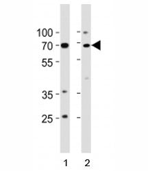 TP73 Antibody