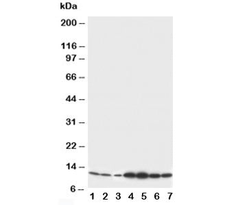 Western blot testing of S100 beta antibody and Lane 1: rat brain; 2: rat brain; 3: MCF-7; 4: HeLa; 5