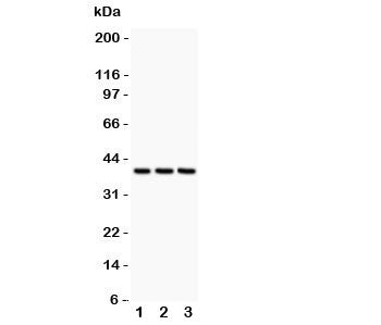 Western blot testing of CXCR6 antibody and Lane 1: HeLa; 2: Jurkat; 3: MCF-7 lysate. Expected/observ