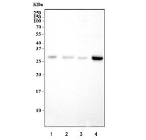 Connexin 26 Antibody / GJB2