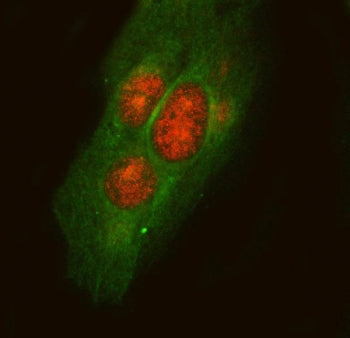 Immunofluorescent staining of FFPE human U-2 OS cells with LPLA2 antibody (red) and Alpha Tubulin mA