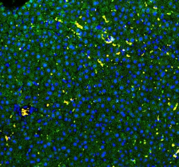 GSTA Antibody (alpha 1-5)