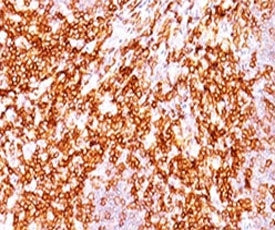 CD68 Antibody