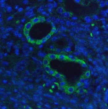 HK1 Antibody / Hexokinase 1