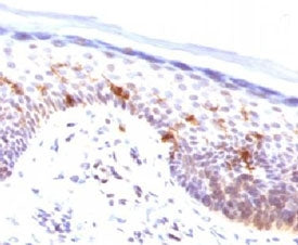 IHC testing of FFPE human skin stained with CD1a antibody (clone CLDA1a). Staining of formalin-fixed