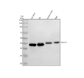 Western blot analysis of HEXIM2 using anti-HEXIM2 antibody. Electrophoresis was performed on a 10% S