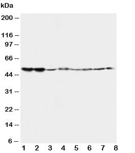 Western blot testing of 5HT2A Receptor antibody and Lane 1: rat brain; 2: rat brain; 3: mouse brain;