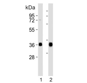 HLA-DQA1 Antibody