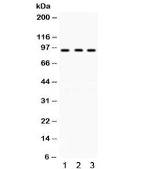 GCN5 Antibody / KAT2A