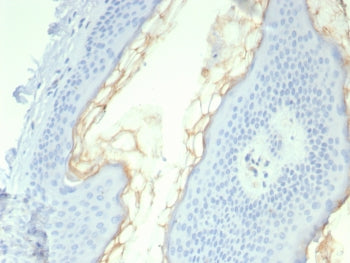 Kallikrein 5 Antibody / KLK5