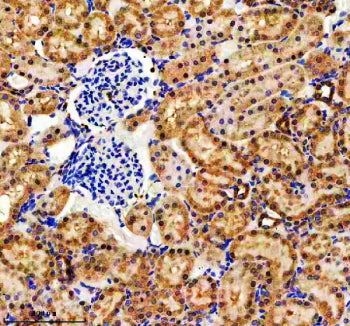 Immunohistochemical staining of EVC2 using anti-EVC2 antibody. EVC2 was detected in a paraffin-embed