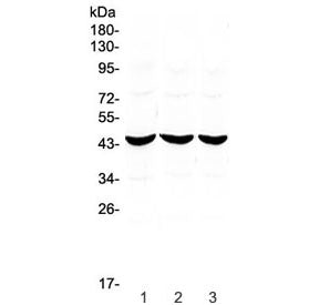 Western blot testing of 1) rat stomach, 2) rat kidney and 3) mouse small intestine lysate with ADA a