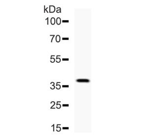 Western blot testing of recombinant human protein with DKK1 antibody. Predicted molecular weight: 26